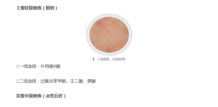 请查收治疗青春痘的权威手册