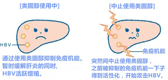 乙肝的治疗方法 乙肝的治疗方法