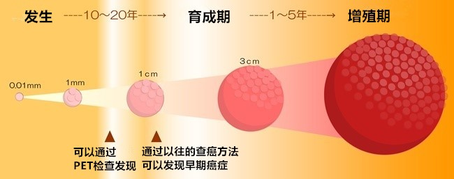 癌症筛查方法大全 癌症筛查方法大全