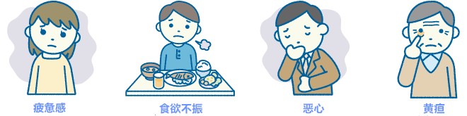 丙肝不容小觑,治疗需及时 丙肝不容小觑,治疗需及时