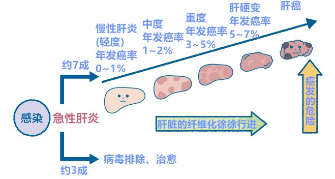 丙肝不容小觑,治疗需及时 丙肝不容小觑,治疗需及时
