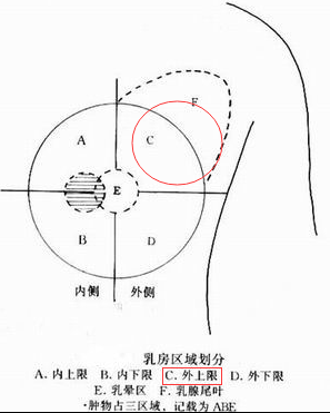 自查三部曲 JMS带你远离乳腺癌 自查三部曲 JMS带你远离乳腺癌