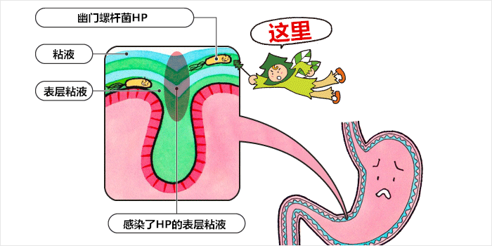 夏天小心胃肠炎,更要小心... 夏天小心胃肠炎,更要小心...