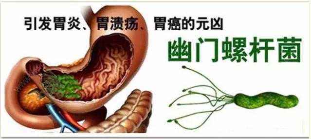 胃癌的8大症状及10大成因,你知道多少? 胃癌的8大症状及10大成因,你知道多少?