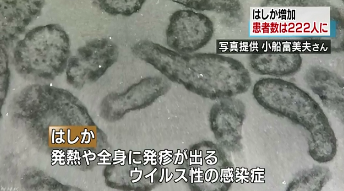 日本全国麻疹患者激增 大阪一周新增24人 日本全国麻疹患者激增 大阪一周新增24人