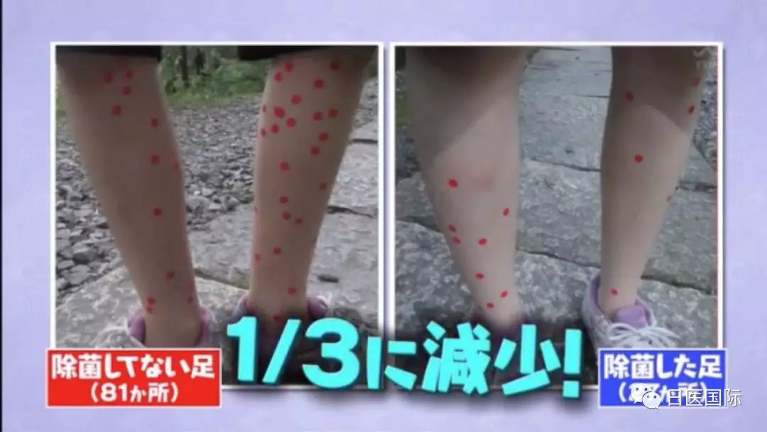 日本天才少年发现防蚊咬秘技 一招击退蚊患! 日本天才少年发现防蚊咬秘技 一招击退蚊患!