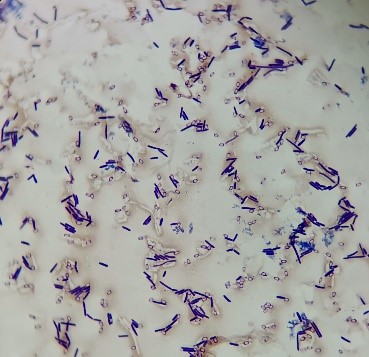 微生物檢驗中常用的染色方法介紹