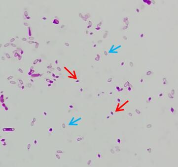 微生物檢驗中常用的染色方法介紹