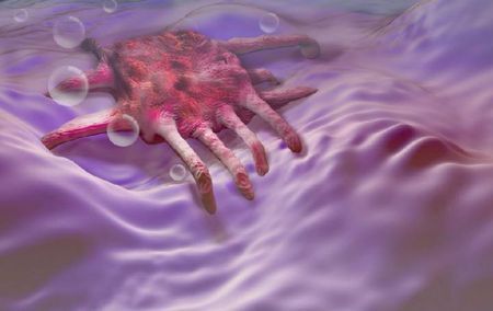 解读:癌细胞为什么能够四处转移、生根? 解读:癌细胞为什么能够四处转移、生根?