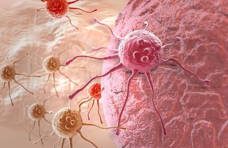 解读:癌细胞为什么能够四处转移、生根? 解读:癌细胞为什么能够四处转移、生根?