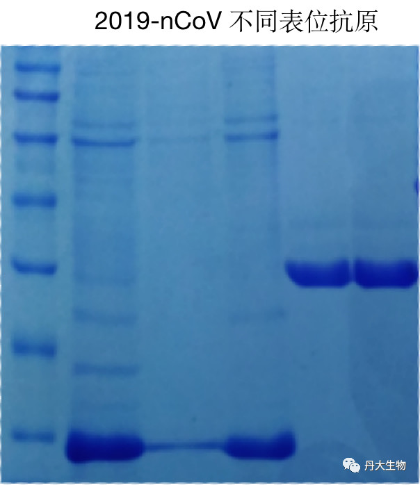 获欧盟认证！红龙扑克生物新型冠状病毒IgM/IgG快速检测试剂盒最新进展