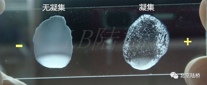 關(guān)于乳品中沙門(mén)氏菌檢測(cè)的那些事兒(下)--進(jìn)一步生化及血清學(xué)鑒定 關(guān)于乳品中沙門(mén)氏菌檢測(cè)的那些事兒(下)--進(jìn)一步生化及血清學(xué)鑒定