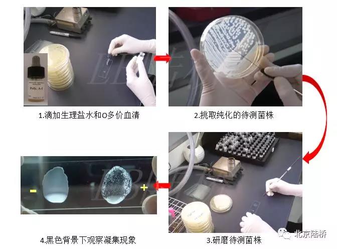 關(guān)于乳品中沙門(mén)氏菌檢測(cè)的那些事兒(下)--進(jìn)一步生化及血清學(xué)鑒定 關(guān)于乳品中沙門(mén)氏菌檢測(cè)的那些事兒(下)--進(jìn)一步生化及血清學(xué)鑒定