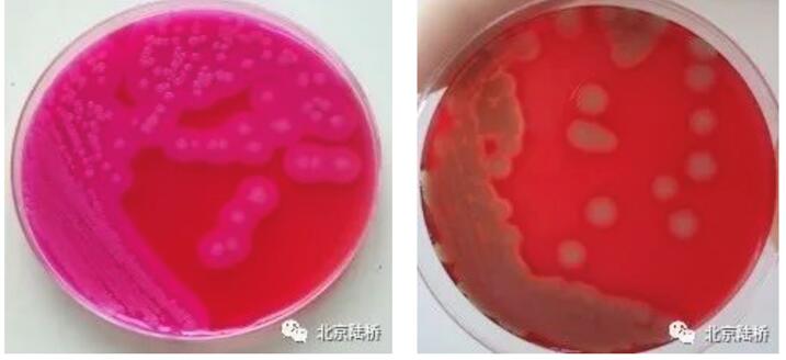 蠟樣芽孢桿菌檢驗(yàn),知多少? 蠟樣芽孢桿菌檢驗(yàn),知多少?
