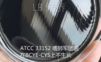 新冠尚未撤退,軍團菌可能又要來襲 新冠尚未撤退,軍團菌可能又要來襲