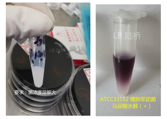 新冠尚未撤退,軍團菌可能又要來襲 新冠尚未撤退,軍團菌可能又要來襲