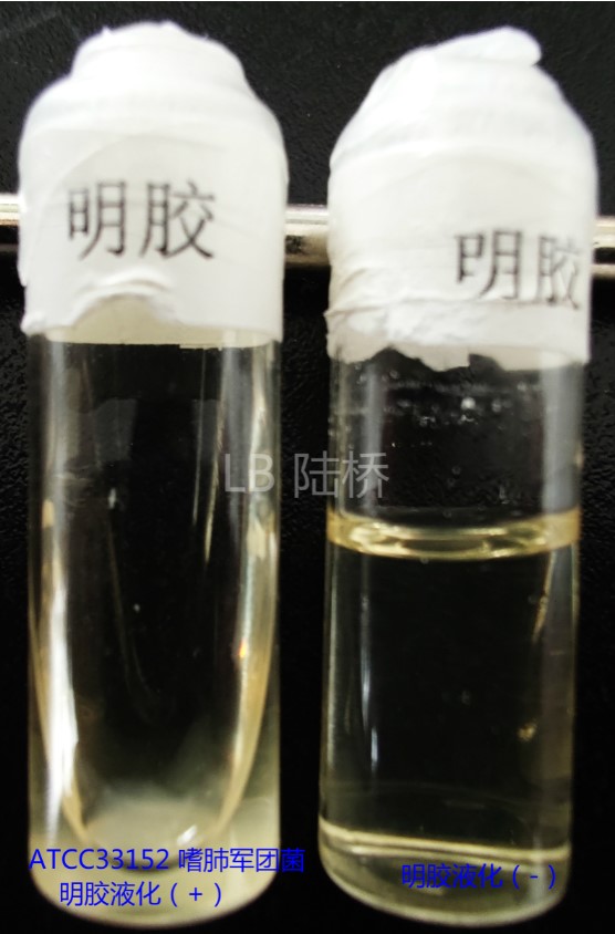 新冠尚未撤退,軍團菌可能又要來襲 新冠尚未撤退,軍團菌可能又要來襲