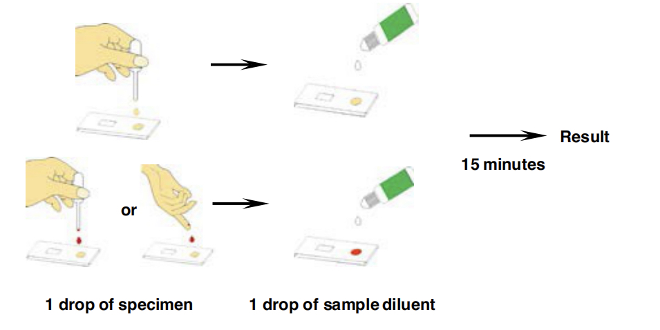 TB IgG/IgM Combo Rapid Test TB IgG/IgM Combo Rapid Test