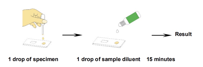 Chikungunya IgM Rapid Test Chikungunya IgM Rapid Test