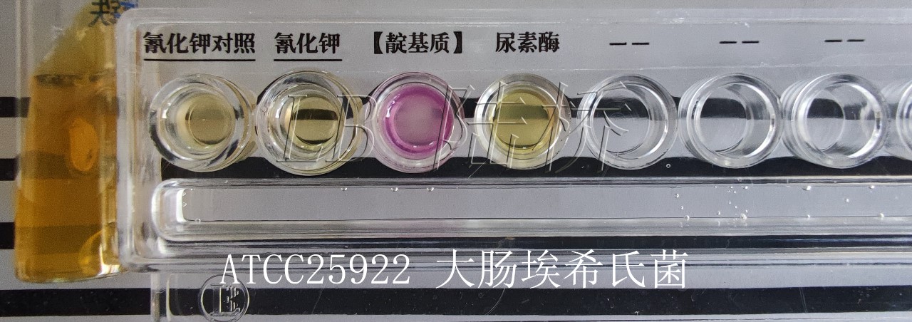 GB4789.6-2016 致瀉大腸埃希氏菌檢驗(yàn)及注意事項(xiàng) GB4789.6-2016 致瀉大腸埃希氏菌檢驗(yàn)及注意事項(xiàng)