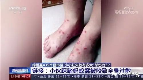小小蚂蚁竟能致死？警惕战斗力最强的外来入侵物种—红火蚁！
