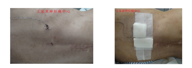 疼痛科 疼痛科
