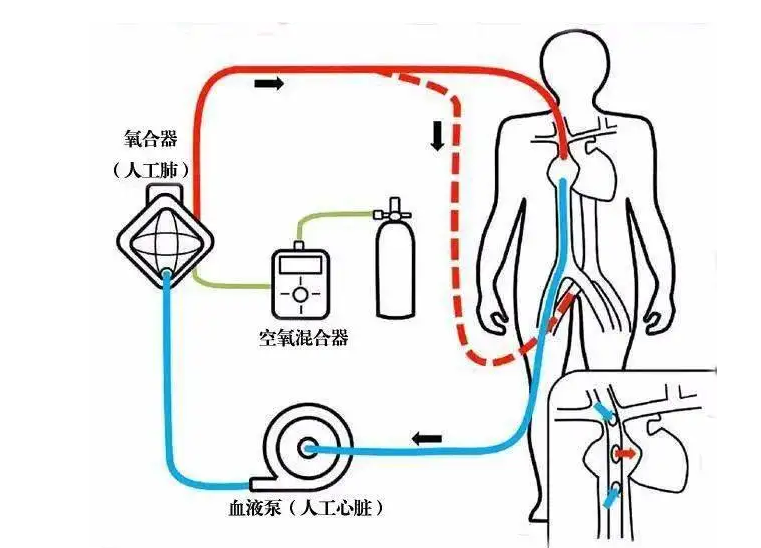 医疗洁净装备供电系统配套工程要分级设计？