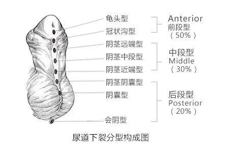 大众科普|什么是包皮过长?要不要手术? 大众科普|什么是包皮过长?要不要手术?
