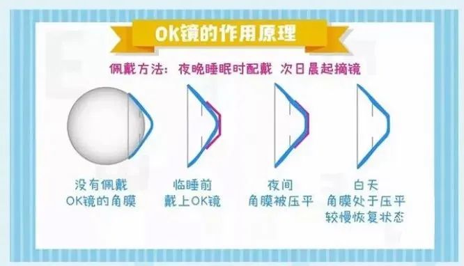 大众科普|开学啦!孩子预防近视六招用起来! 大众科普|开学啦!孩子预防近视六招用起来!