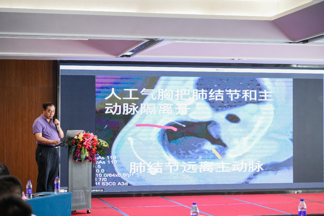 广州金沙肿瘤冷冻消融论坛成功举办 广州金沙肿瘤冷冻消融论坛成功举办