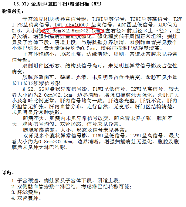肿瘤治疗不要输在起跑线上 肿瘤治疗不要输在起跑线上