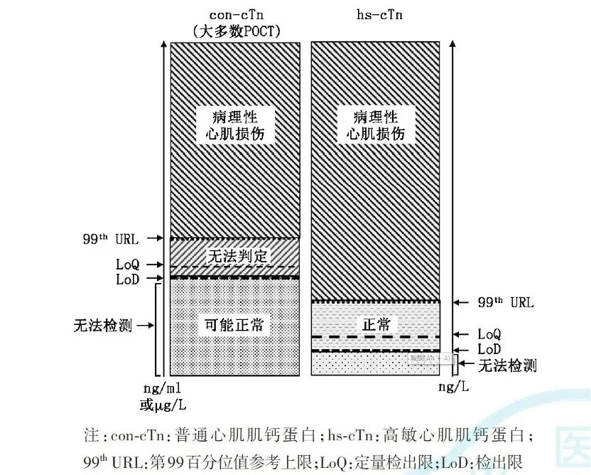 高敏心肌肌钙蛋白的《专家共识》：更高的临床应用价值