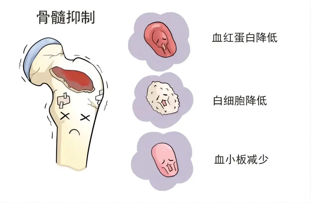 大众科普|肿瘤放化疗副反应——骨髓抑制 大众科普|肿瘤放化疗副反应——骨髓抑制