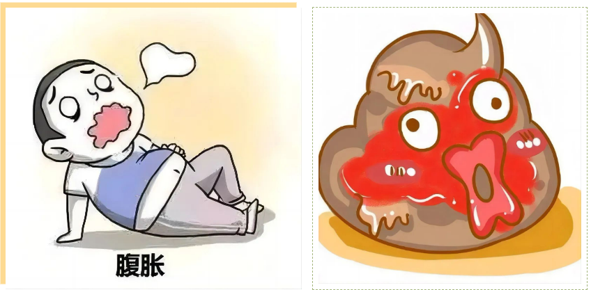大众科普|不容忽视的肠息肉,你了解吗 大众科普|不容忽视的肠息肉,你了解吗