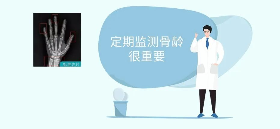 大众科普|骨龄检测有必要吗? 大众科普|骨龄检测有必要吗?