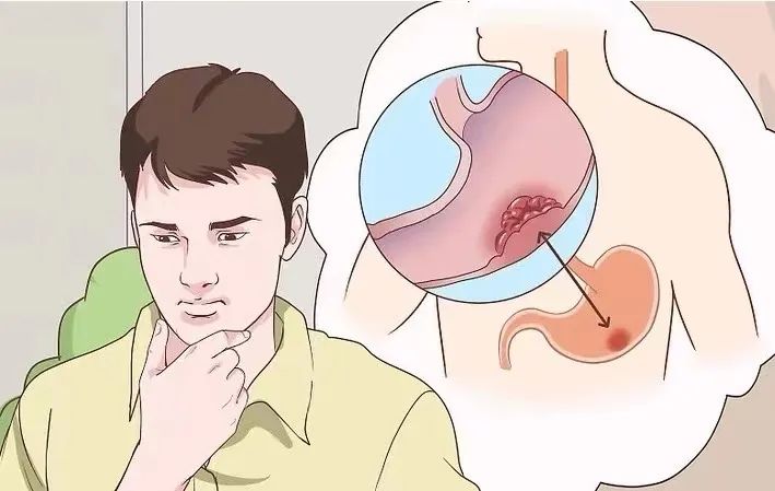 胃癌术后我们要如何护理?患者和家属应该注意什么? 胃癌术后我们要如何护理?患者和家属应该注意什么?