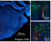 【NeuroNexus客户文章】NEURAL MECHANISMS OF ALTERED SENSORIMOTOR PROCESSING IN ASD AND OTHERS