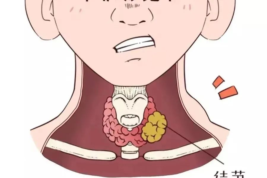 营养课堂|患甲状腺结节后,什么能吃?什么不能吃? 营养课堂|患甲状腺结节后,什么能吃?什么不能吃?