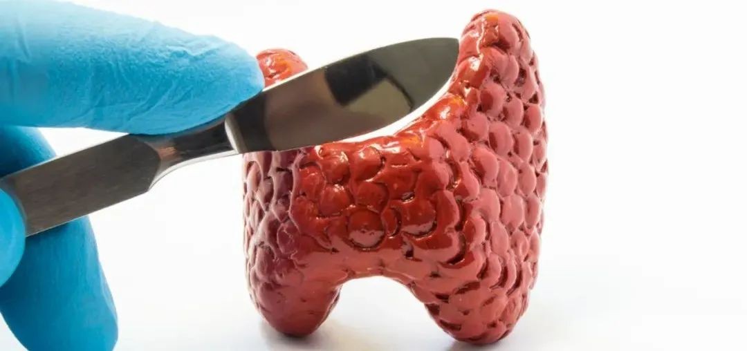 Diagreat’s unique raw materials - raw materials for thyroid function detection that are beyond expe