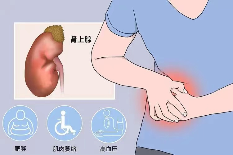 肾上腺瘤的术后护理