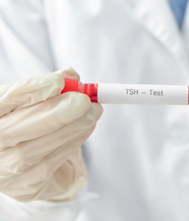 Extremely sensitive and stable, the ultra-high-sensitivity TSH paired raw materials will help you stand out in the thyroid function testing! Extremely sensitive and stable, the ultra-high-sensitivity TSH paired raw materials will help you stand out in the thyroid function testing!