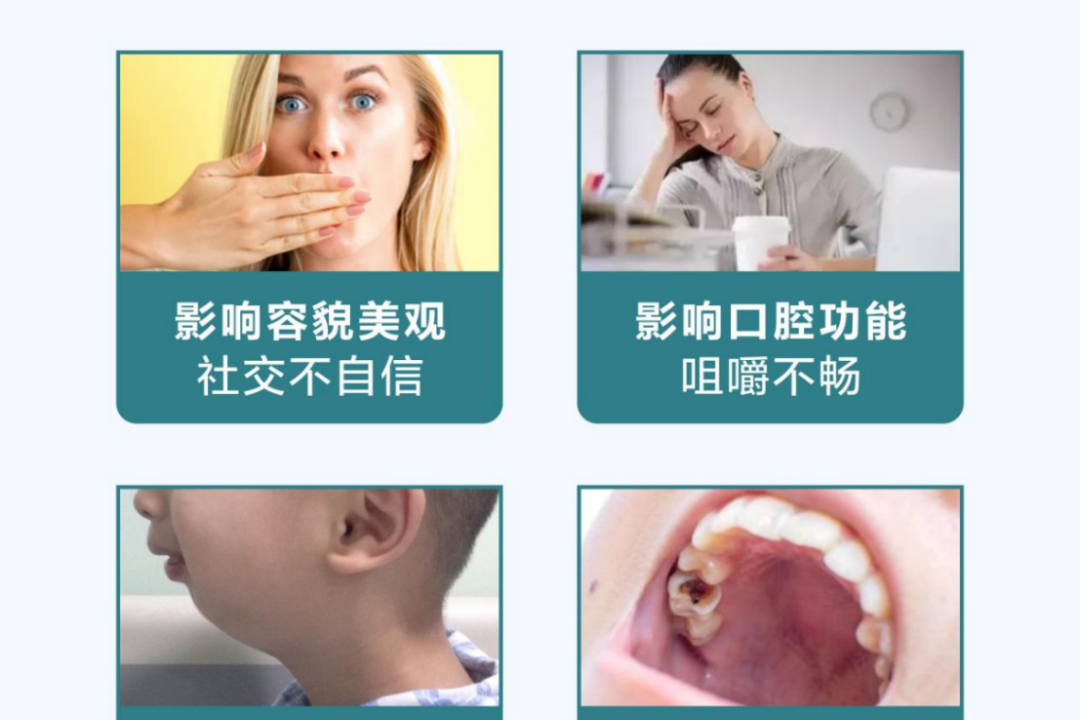 正畸科普 | “整牙”不戴“钢箍”,隐形矫正让你悄悄变美! 正畸科普 | “整牙”不戴“钢箍”,隐形矫正让你悄悄变美!