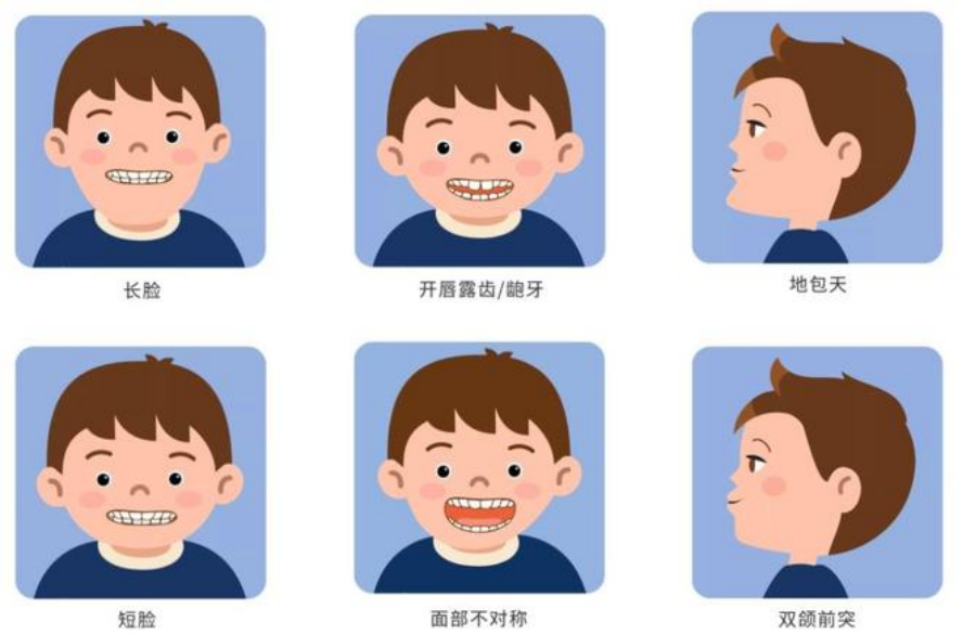 儿童早期矫正 | 孩子必须『换完牙』才能做矫正? 儿童早期矫正 | 孩子必须『换完牙』才能做矫正?