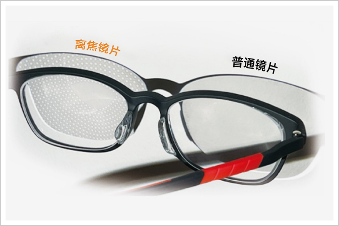 大众科普|离焦眼镜防控近视 大众科普|离焦眼镜防控近视