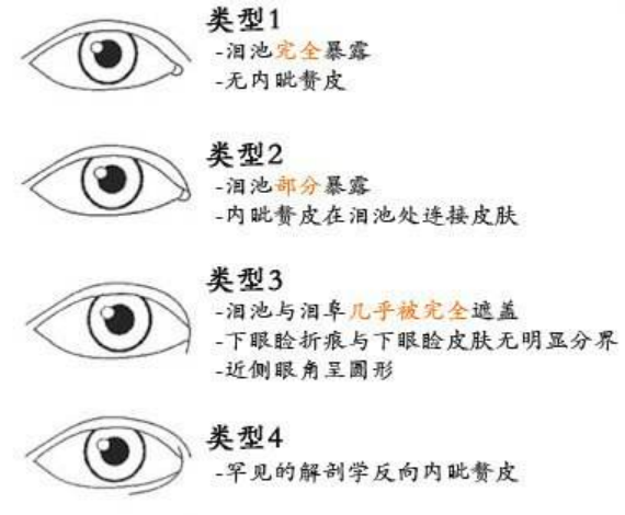大众科普|眼周美容微整形攻略,请您查收~ 大众科普|眼周美容微整形攻略,请您查收~