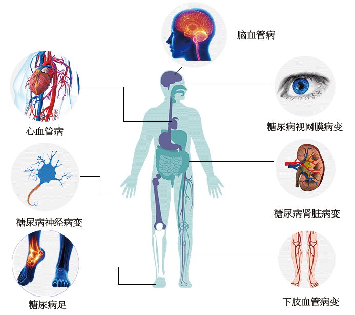 世界防治糖尿病日|了解风险,了解应对 世界防治糖尿病日|了解风险,了解应对