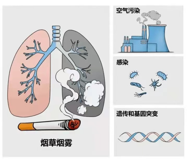 世界慢性阻塞性肺炎日|肺系生命,刻不容缓 世界慢性阻塞性肺炎日|肺系生命,刻不容缓