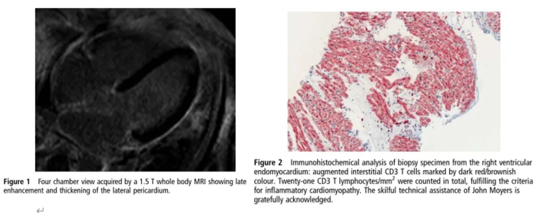 Revealing false or true positivity of high-sensitivity troponin