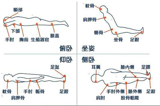 大众科普|“六勤一加强”预防压疮的发生 大众科普|“六勤一加强”预防压疮的发生