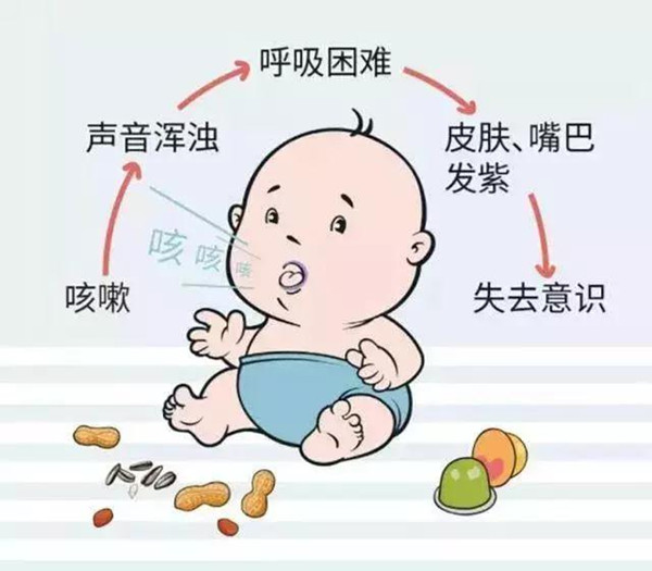 大众科普|小儿气道异物梗阻---“救”在身边 大众科普|小儿气道异物梗阻---“救”在身边